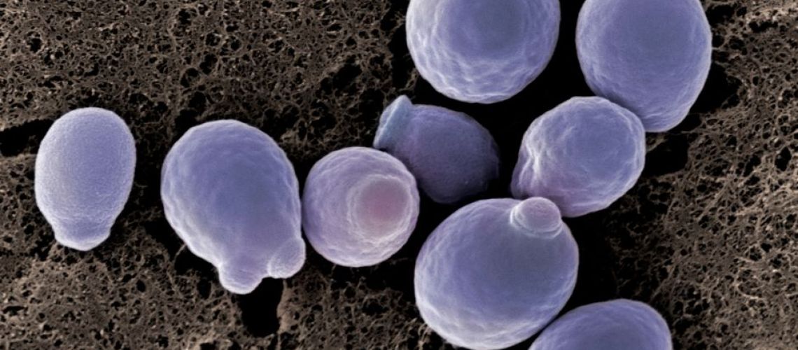 Updates on C. auris