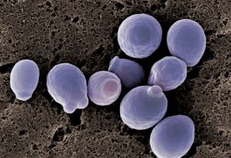 Updates on C. auris