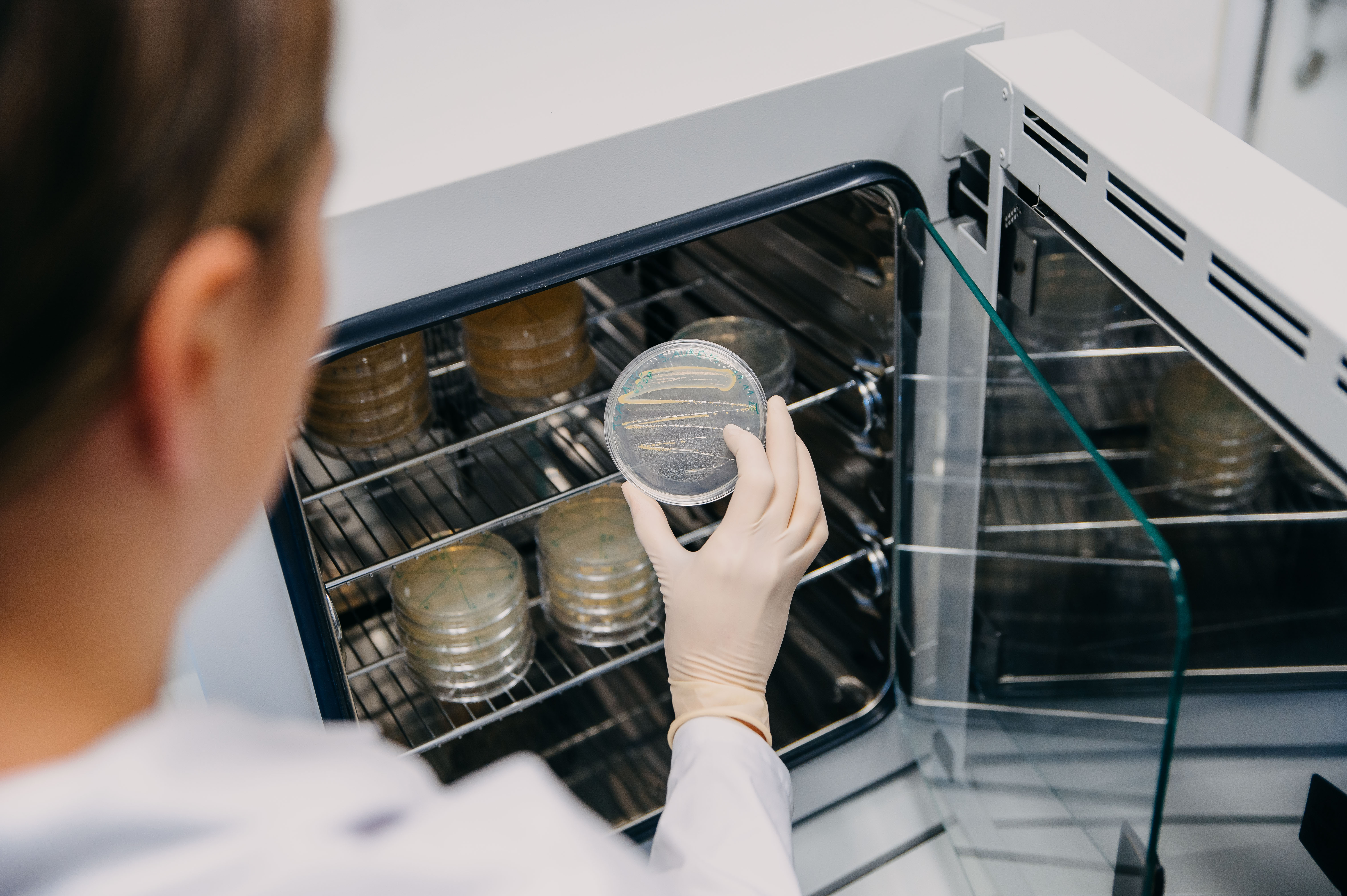 Petri dish with visible colonies